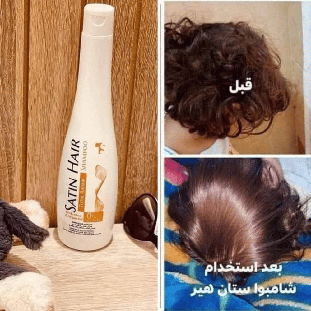 Bazaar - 2026-04-01T204629.210